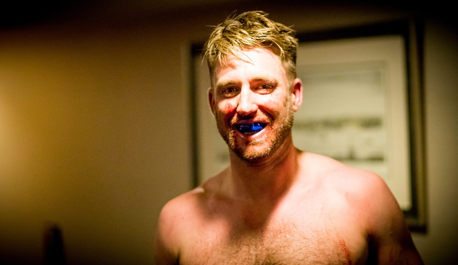 Mouthguard still in, grin still on. Probably shock